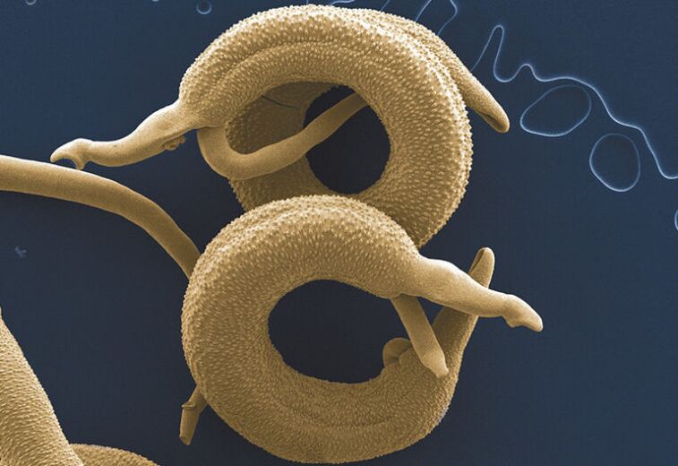 inimkehas elavad parasiidid